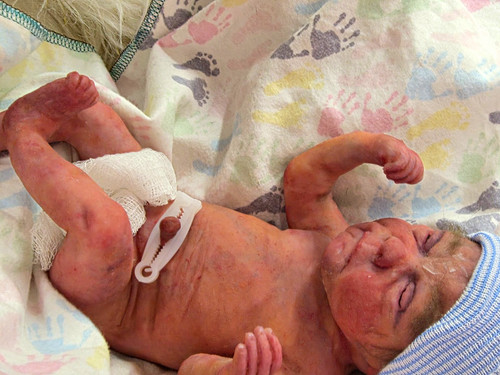 Micro preemie full - preemie,